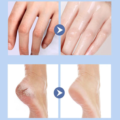 Dry and cracked heels, anti-crack cream, moisturizing cream.