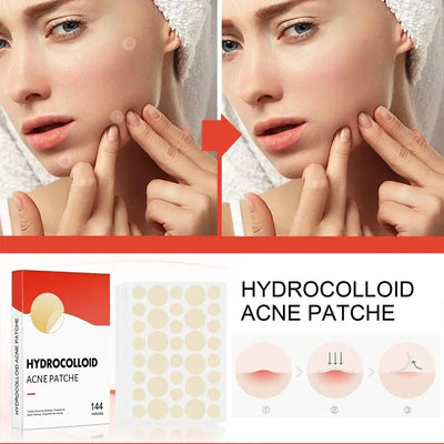 Hydrocolloid Acne Patch Facial Blemishes Pimple Marks Closed