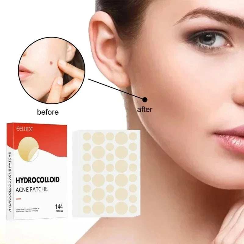 Hydrocolloid Acne Patch Facial Blemishes Pimple Marks Closed