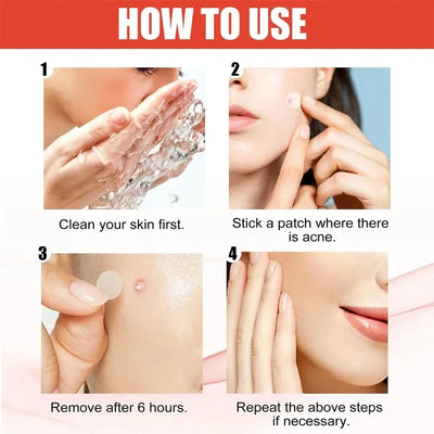Hydrocolloid Acne Patch Facial Blemishes Pimple Marks Closed