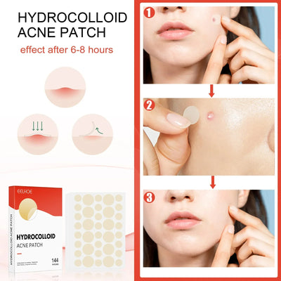 Hydrocolloid Acne Patch Facial Blemishes Pimple Marks Closed